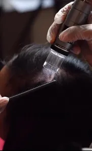 Consultation + Scalp Imaging analysis + Diagnosis Only